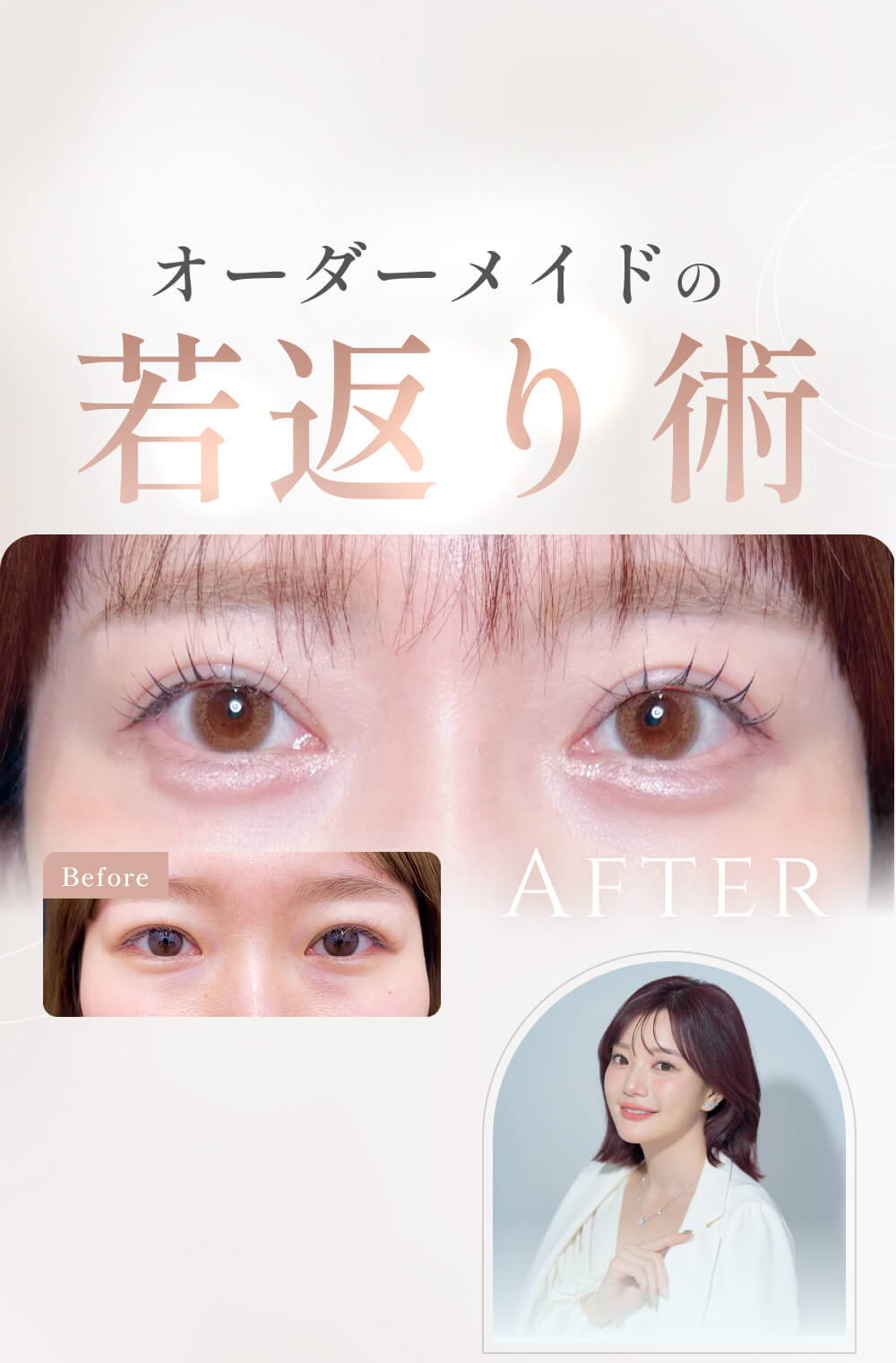オーダーメイドの若返り術：上品な目元ケアのbeforeとafterの写真