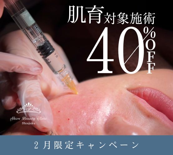 2月キャンペーン