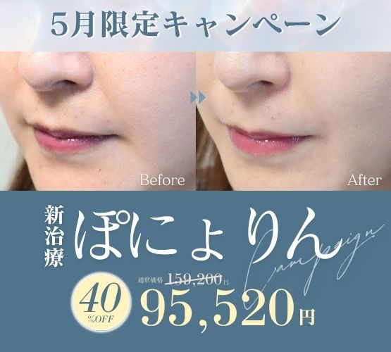 新治療「ぽにょりん」