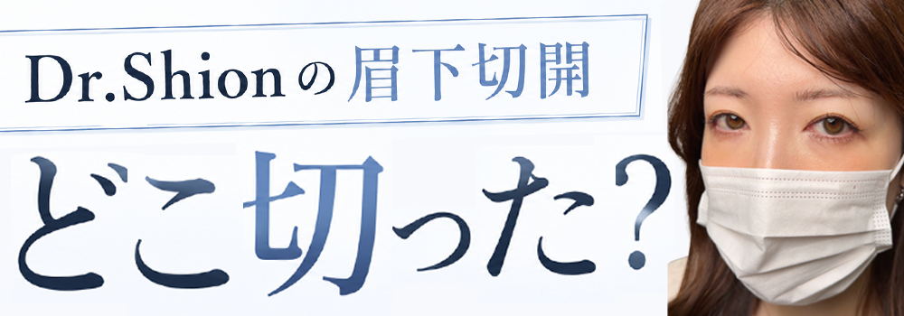 眉下切開バナー
